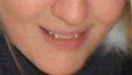 close-up of the fangs